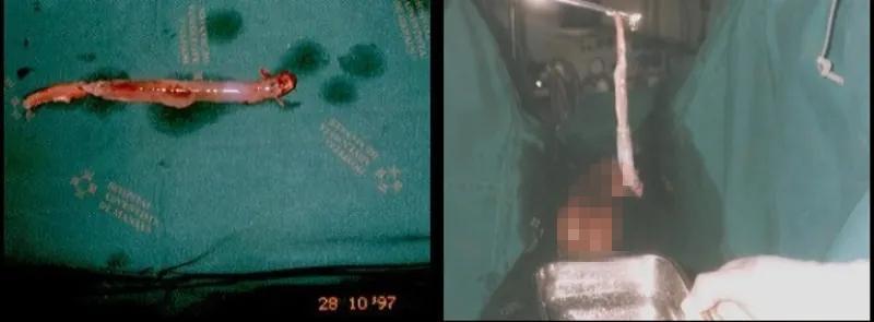 可怕的牙签鱼：嘴上长倒勾，会钻进男人丁丁，拽都拽不出来