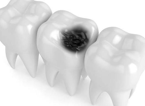 牙痛的用药技巧你知道多少,治牙痛建议收藏