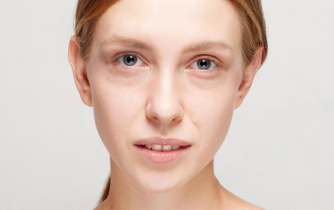 29岁长斑黑眼圈怎么回事,黑眼圈严重长斑是哪里出问题