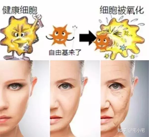 美白淡斑和美白祛斑有什么区别吗,美白和祛斑的区别