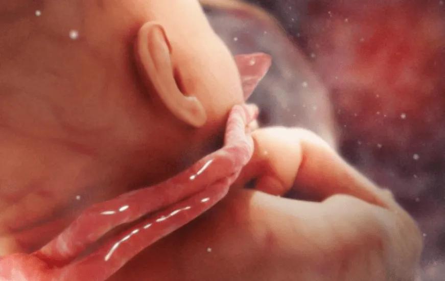 胎儿单脐动脉有什么影响,产检b超上提示建议复查