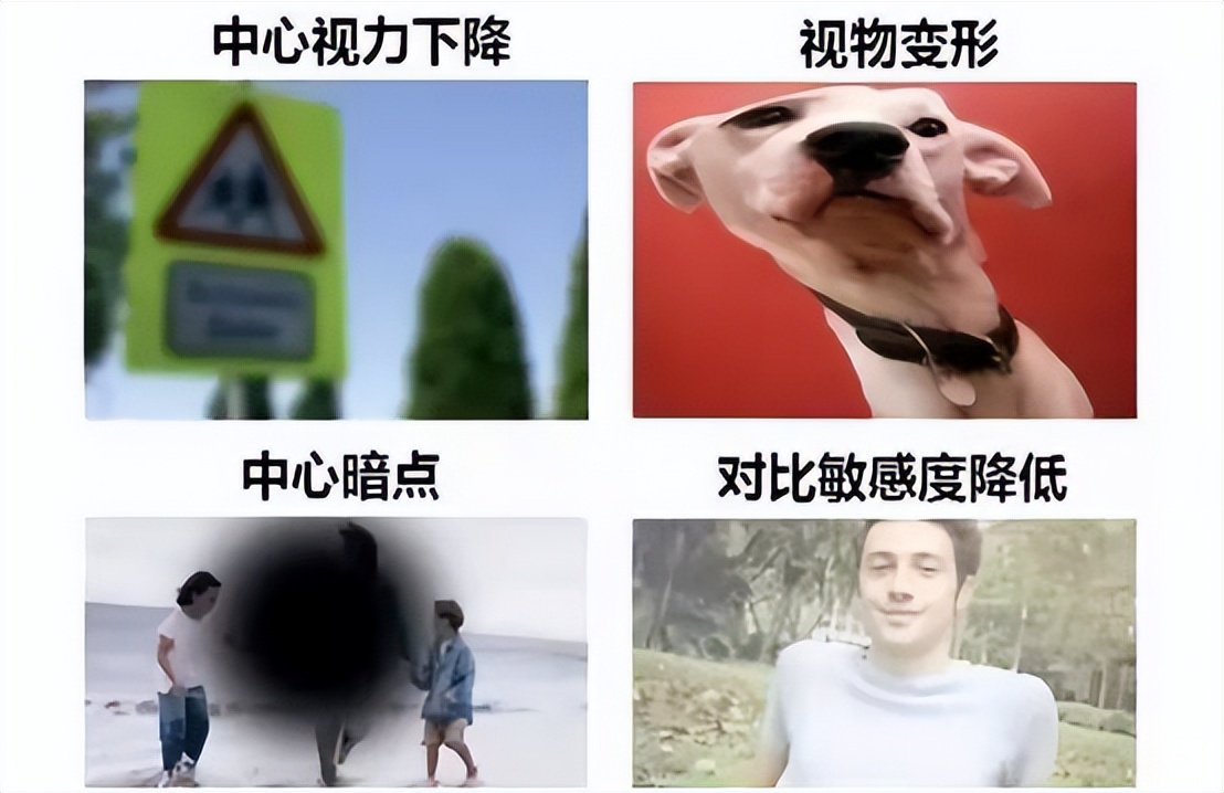 视百年可以治视神经萎缩吗,视百年眼科怎样