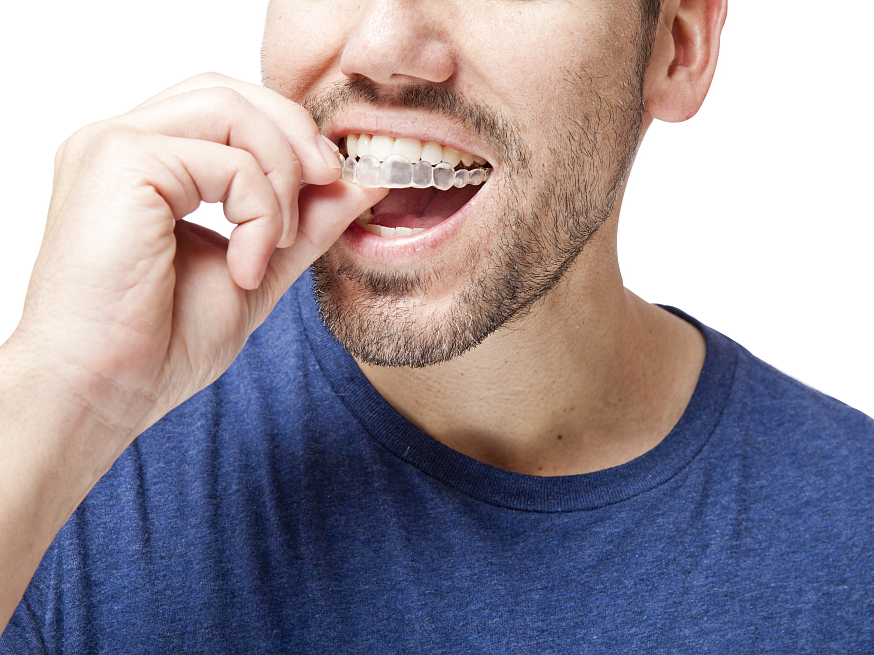 artsmile,Artsmile牙齿隐形矫正