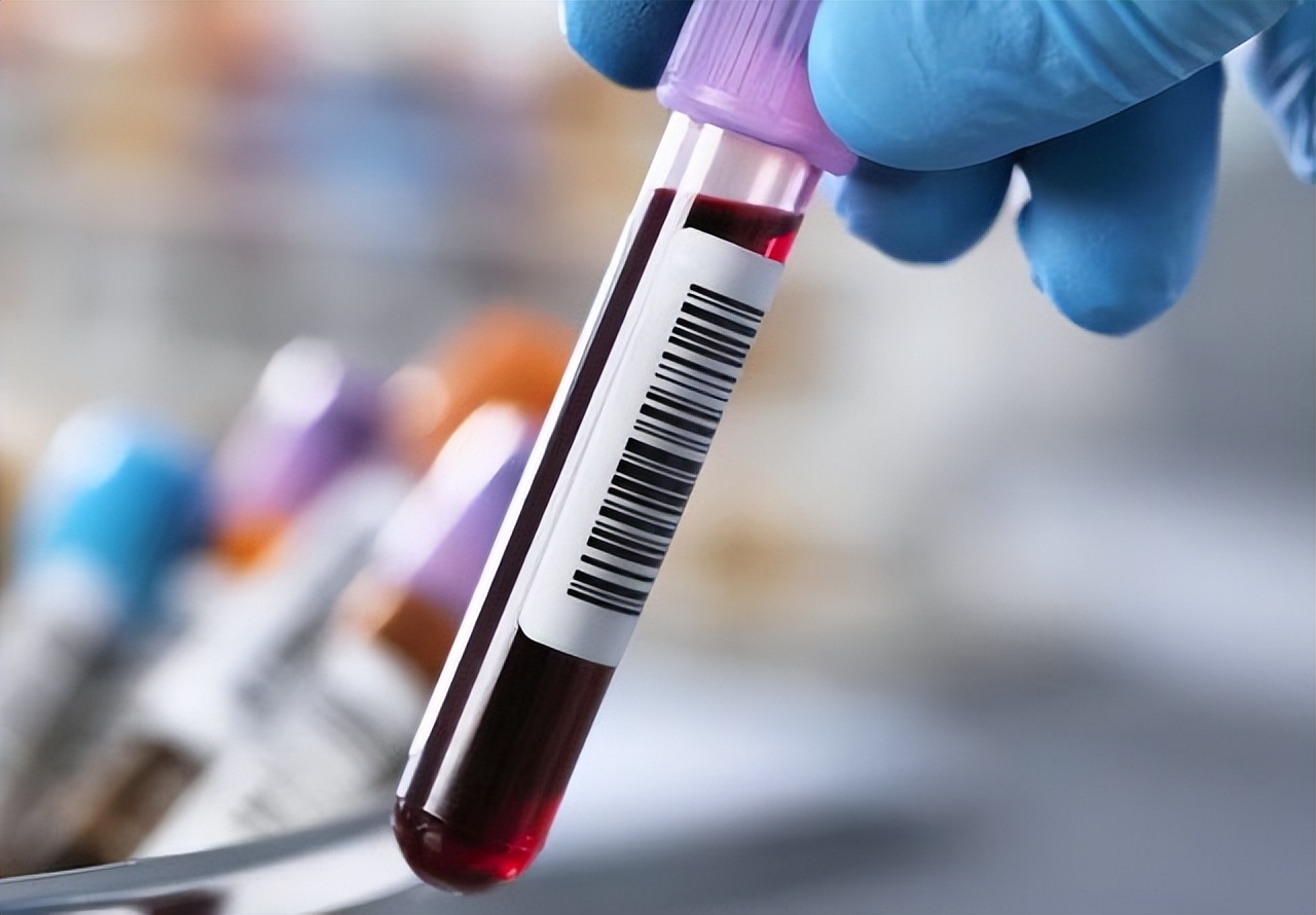 肾病高血压可以吃阿利沙坦酯,沙坦类降压药对血脂和尿酸的影响