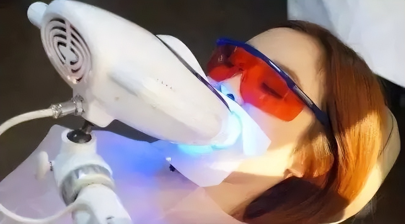 牙齿冷光美白是什么,牙齿冷光美白有副作用么