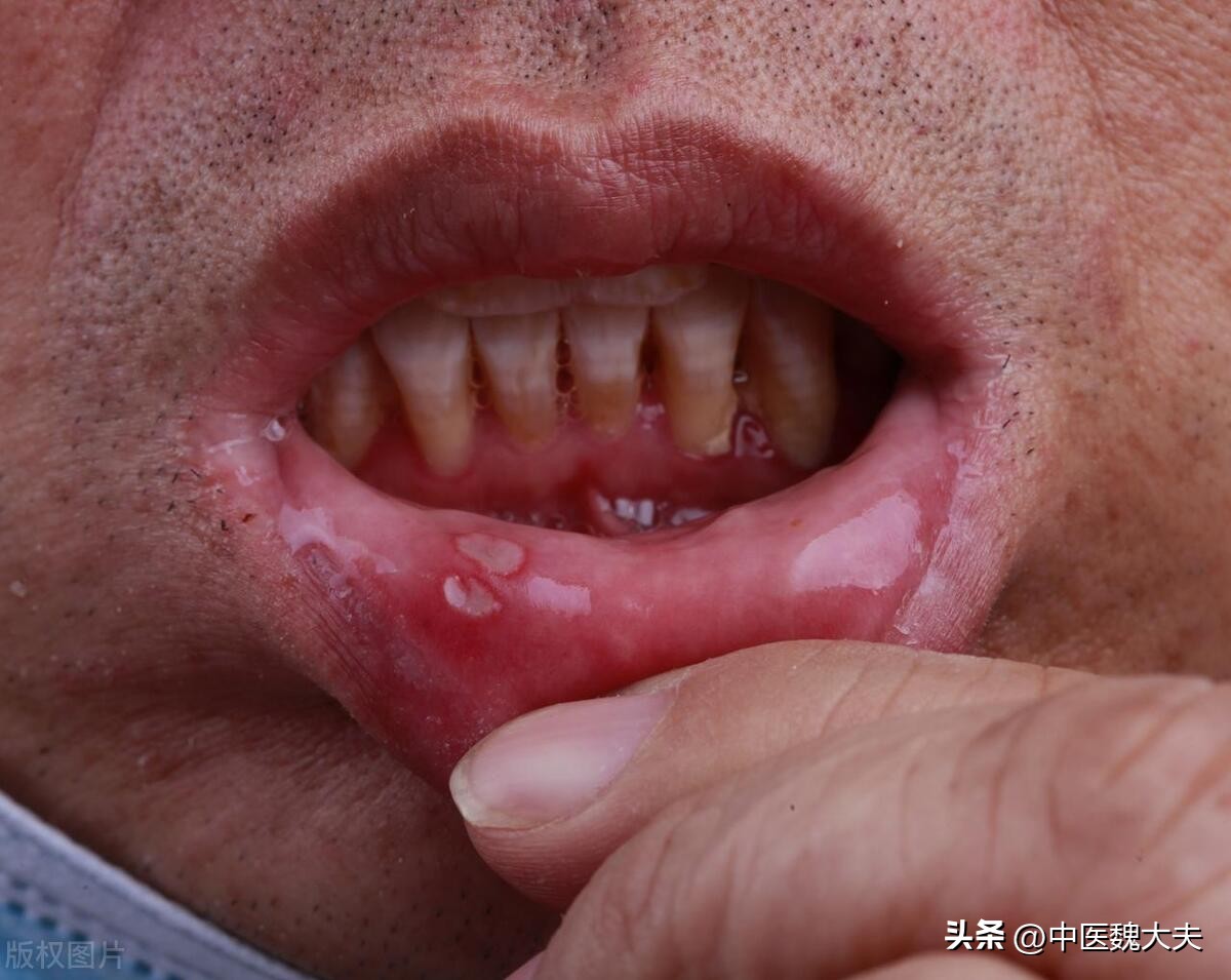 人体缺乏维生素身体有哪些信号,人体缺乏维生素b2的表现