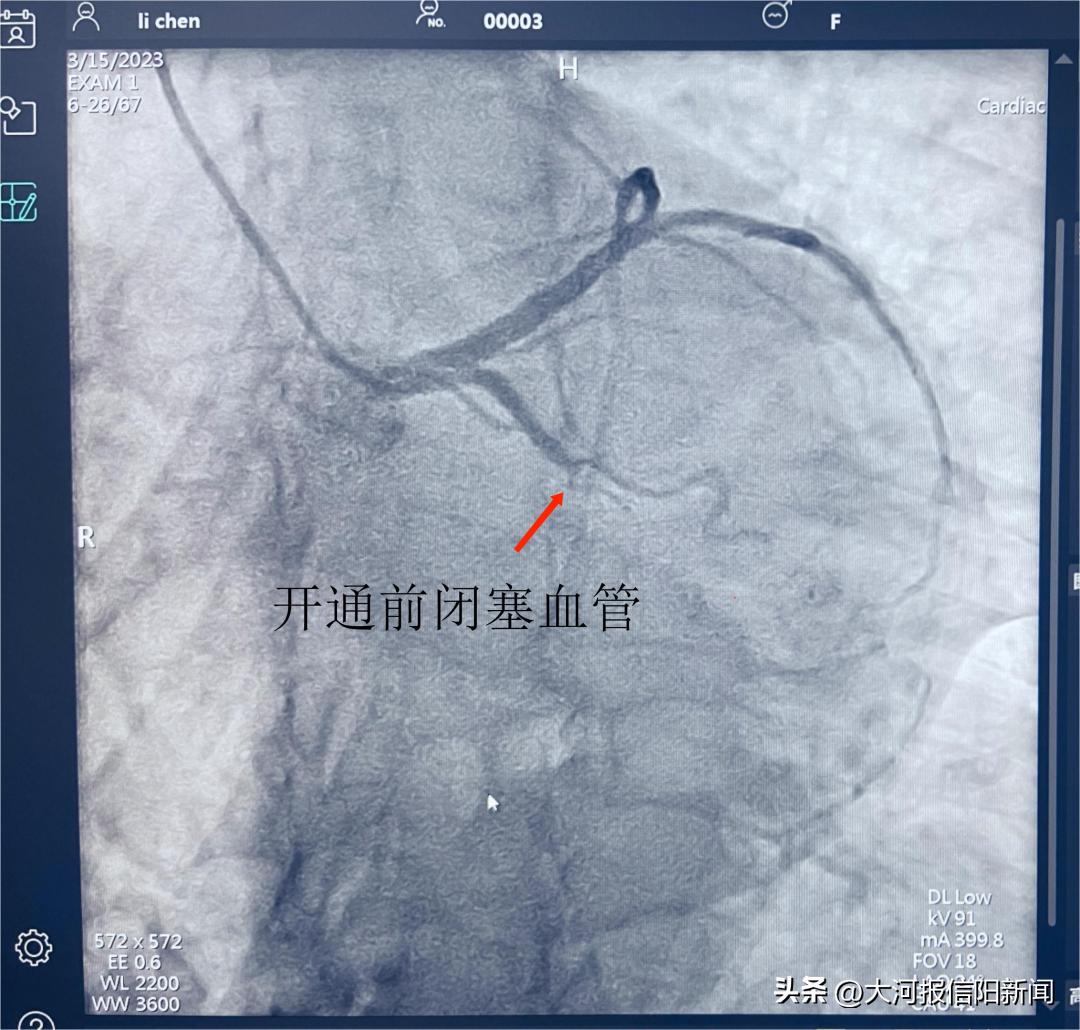 信阳医院手术室及病房净化,信阳中心医院手术室