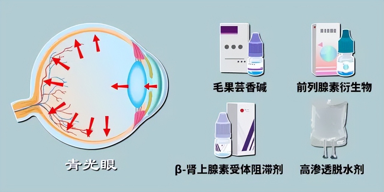 青光眼是怎么造成的,青光眼的症状和表现