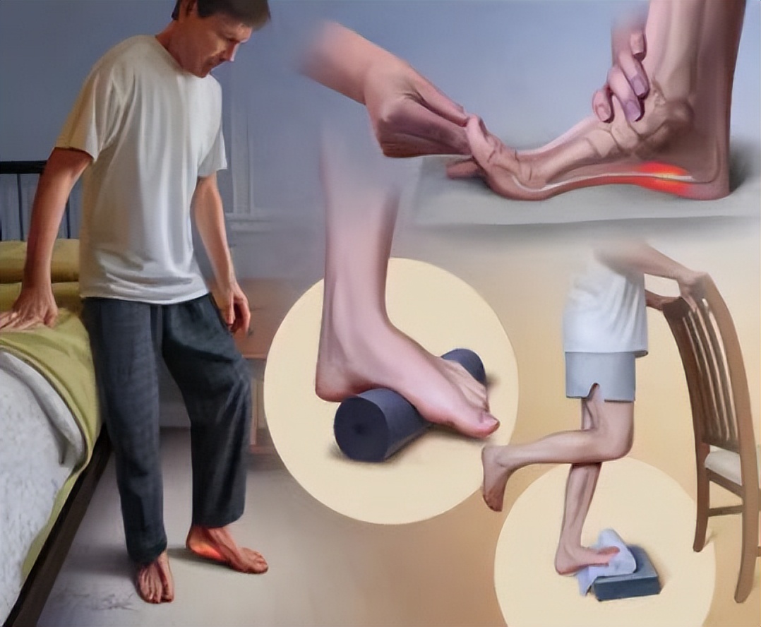 足底筋膜炎康复方法,足底筋膜炎康复训练视频