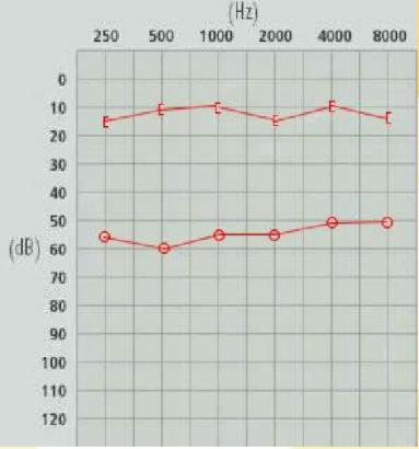 爱耳小知识,爱耳日科普