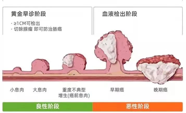 粪便dna检查直肠癌多少钱,大便dna筛查准确率有多高