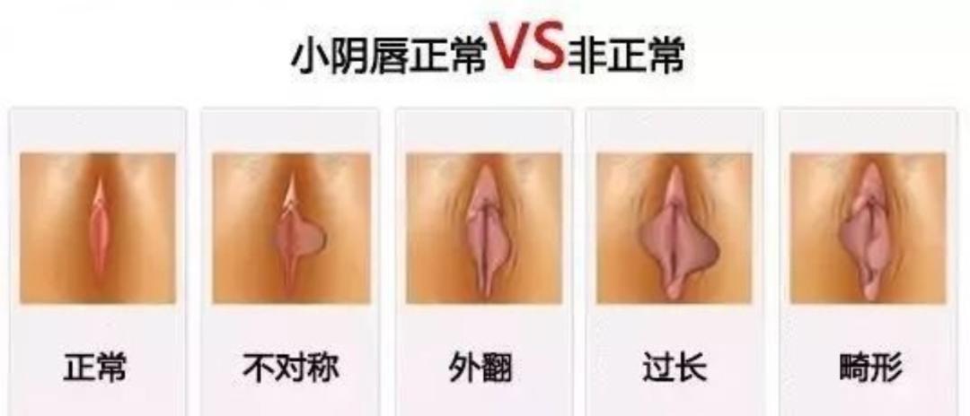 走路或骑车颠簸背上部疼痛,走路摩擦有疼痛感擦什么药