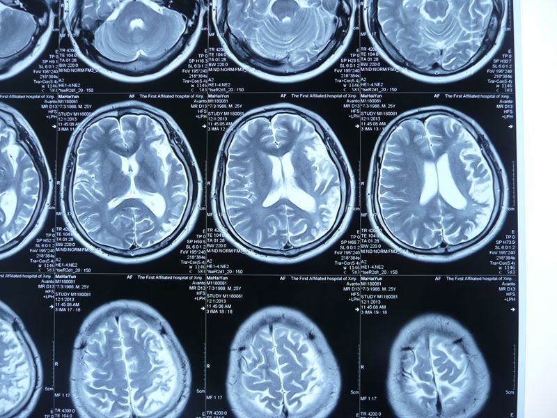 贺晓生视频,贺晓生神经外科教授视频