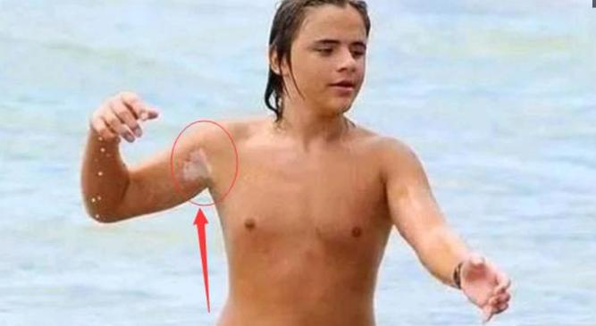 迈克尔杰克逊去世得了什么疾病,迈克杰克逊儿子遗传白化病