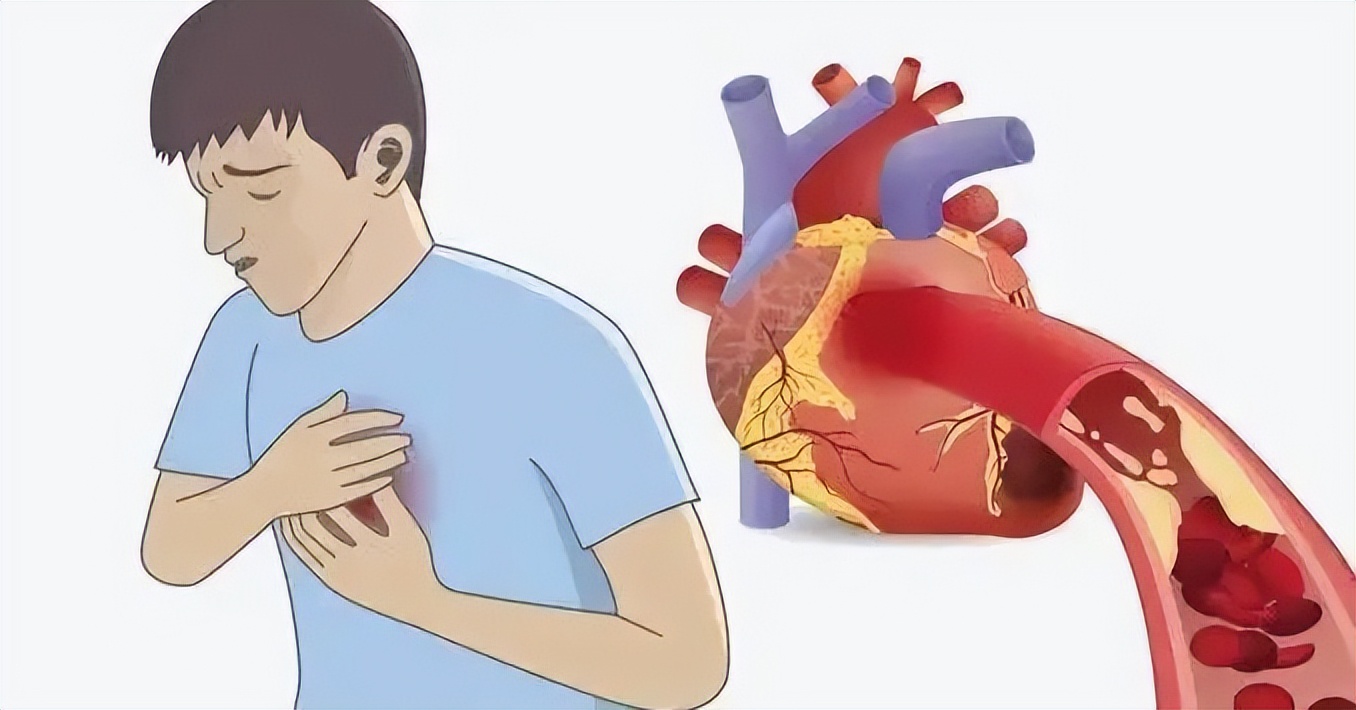 夏天防中暑特效药有卖吗,夏季酷暑防中暑的药