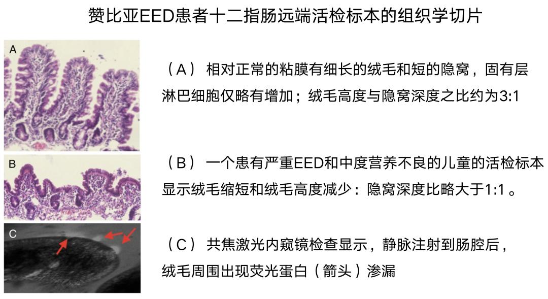 营养不良发育迟缓怎么办,宝宝发育迟缓营养不良不开口说话