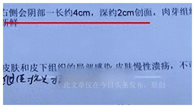 太惨了，湖北女幼师被咬隐私部位，狗主人拒赔，女子：我怎么嫁人