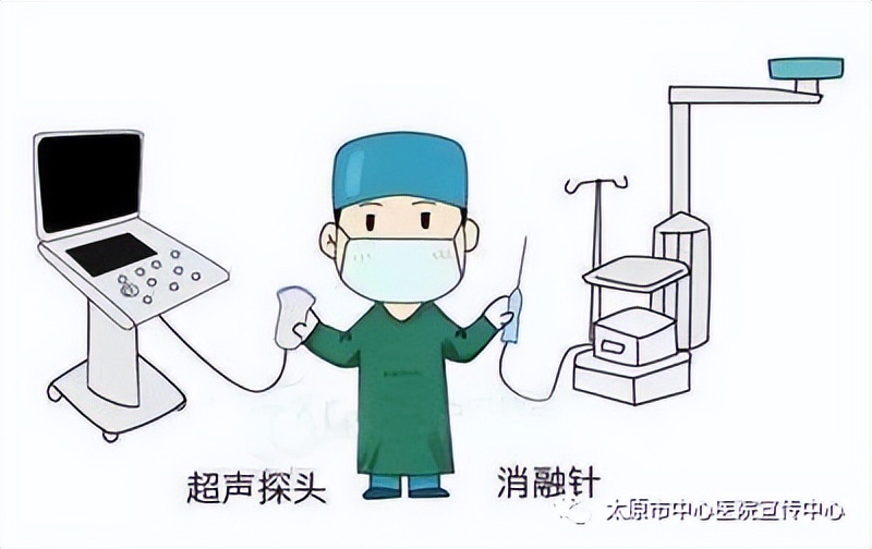 微波消融术可以治乳腺癌吗,乳腺结节微波消融术多少钱一次