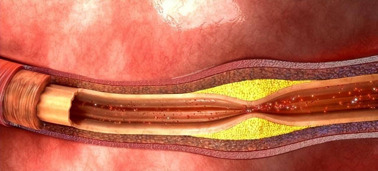 男人疲软性能力低？可能不只是“那儿”的问题，这些因素不可忽视