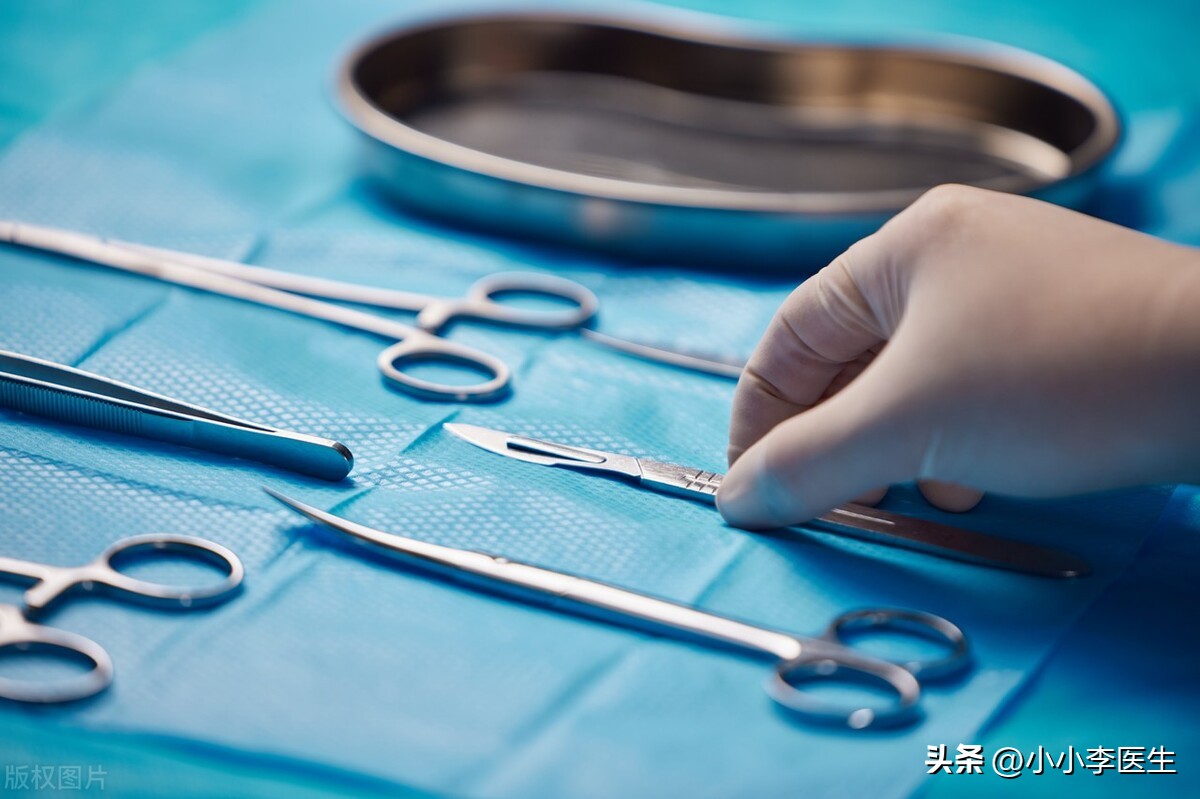 激光祛痣笔真的有用吗,冷冻祛痣好还是激光好