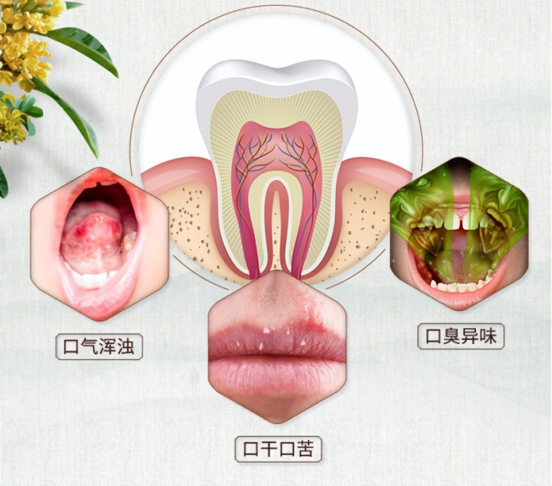 最有效的除口臭牙膏推荐,哪种牙膏去口臭抑菌效果好