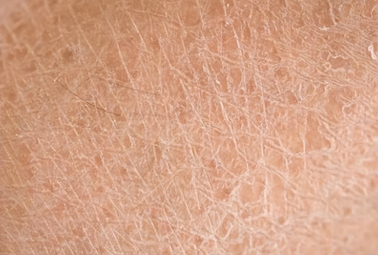 男生脸上很多处脱皮怎么办,男生脸上脱皮干燥