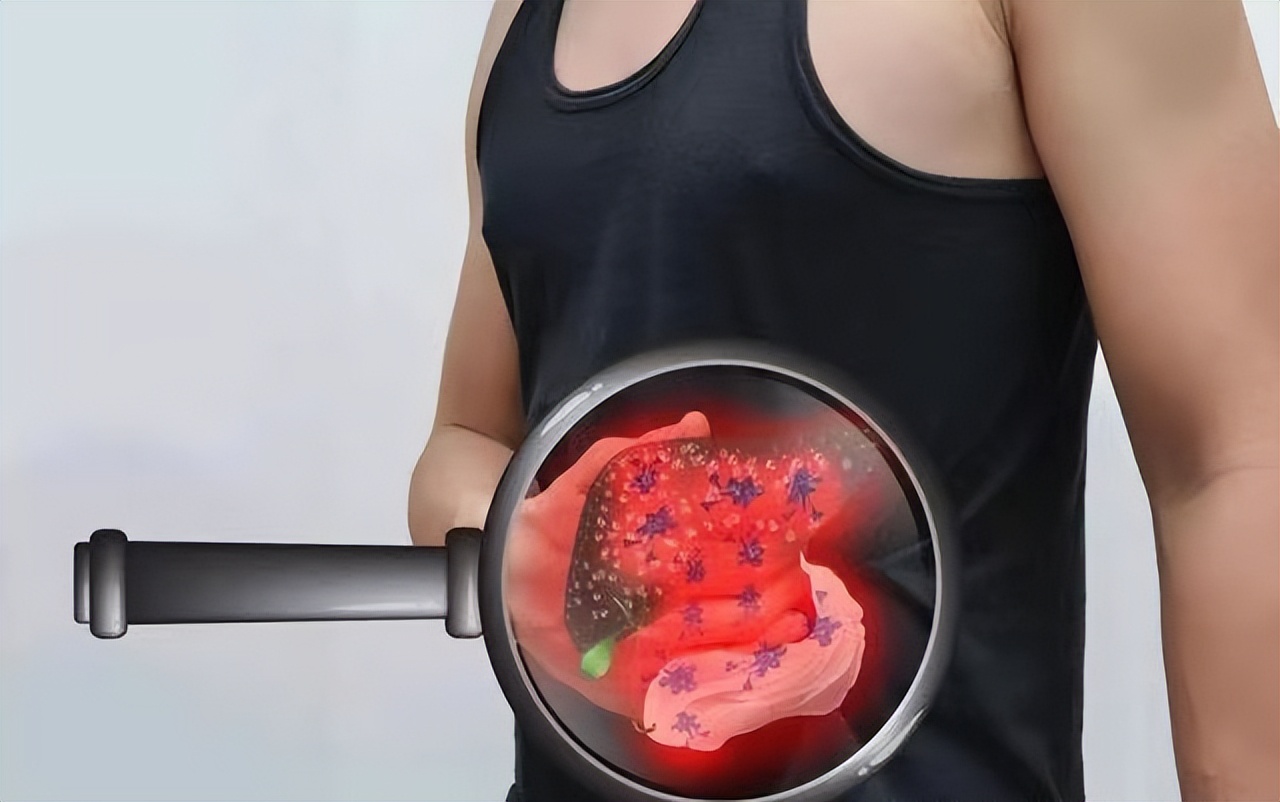 一直抗病毒会肝纤维化吗,一直抗病毒治疗出现胆红素升高