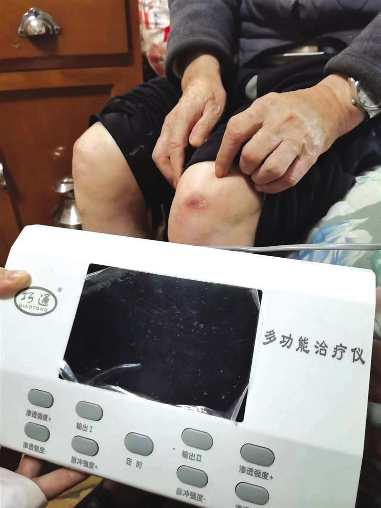 ■记者跑腿之为民解忧治疗仪烫伤老人双膝经销商同意全额退款