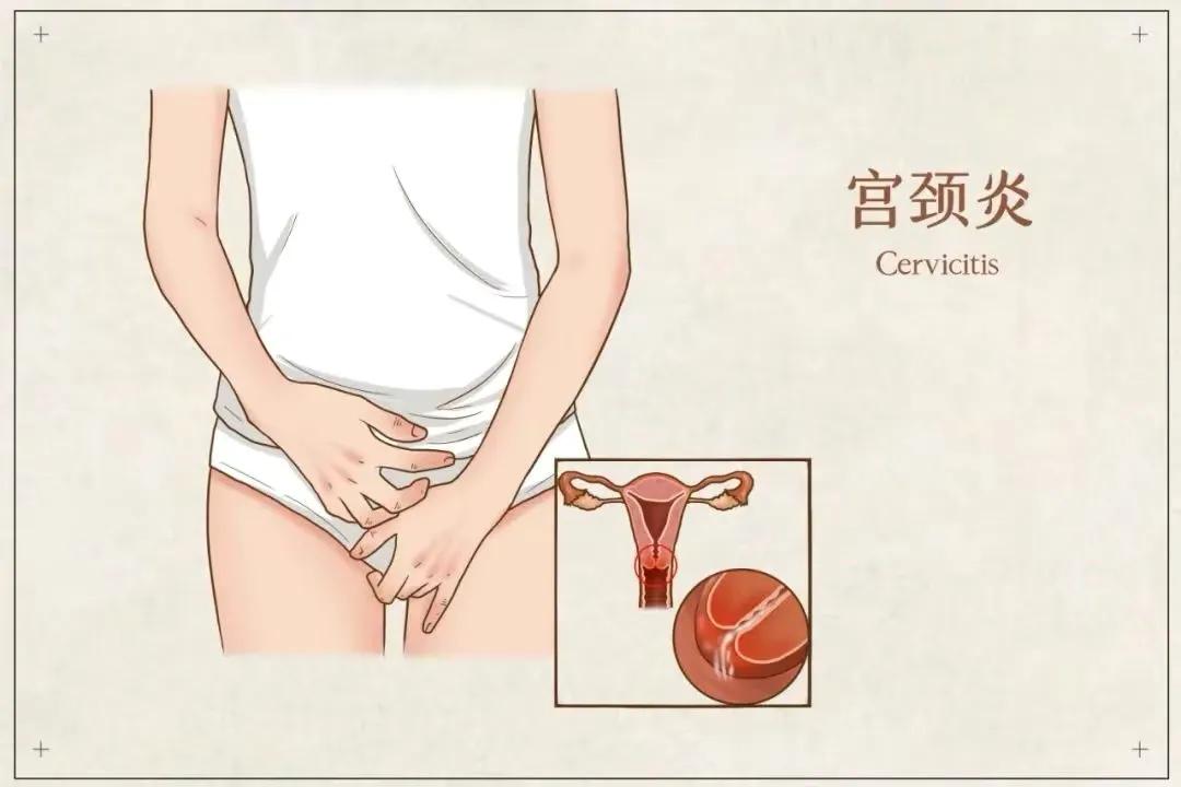 鎵粍鎶撹祵璁板綍,鎵粍鎶撹祵