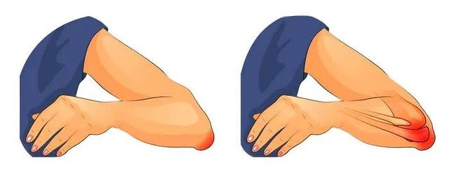 一文读懂什么是肌筋膜炎,一文读懂膝关节