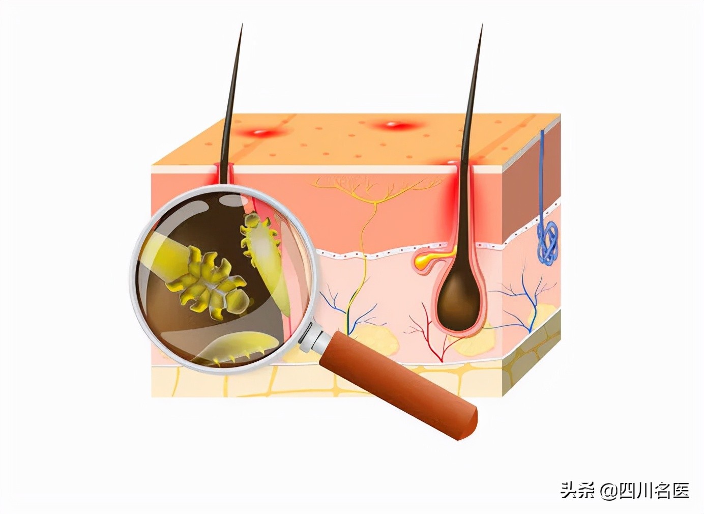 头屑多可能是脱发前兆,头屑越来越多是脱发的表现吗