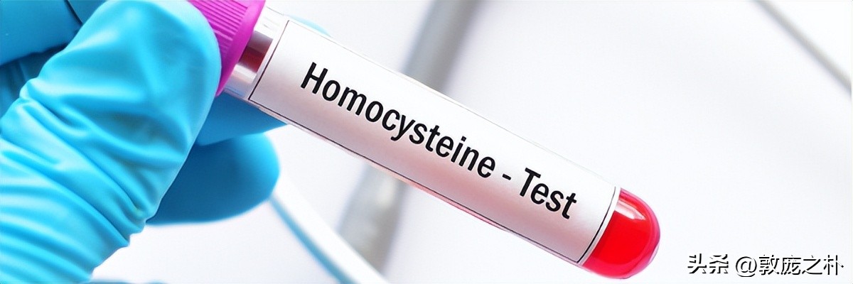 血液检验同型半胱氨酸高怎么回事 (高同型半胱氨酸血症算血液异常不)
