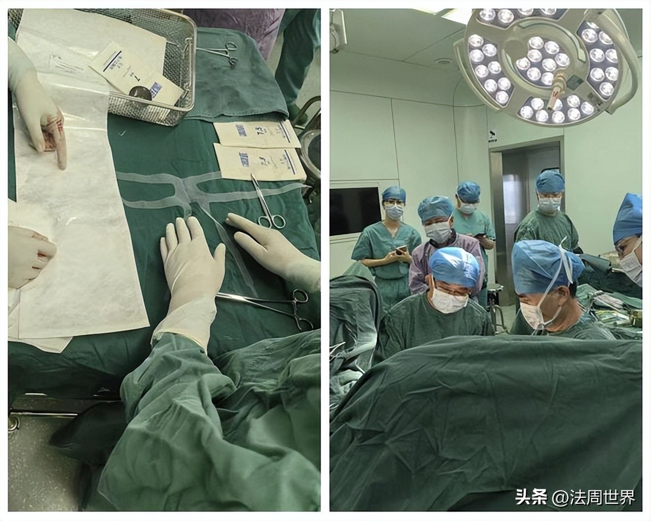 常德一医泌尿外科为复发性盆底脏器脱垂患者实施全盆底重建术