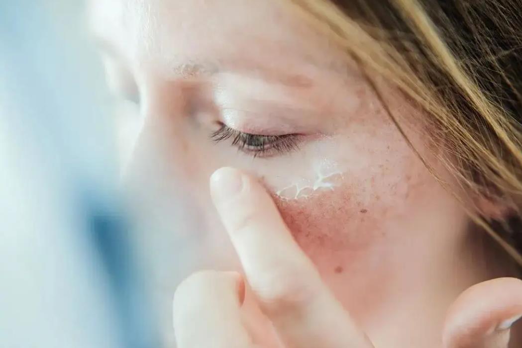 去眼纹的正确方法,眼纹干货分享