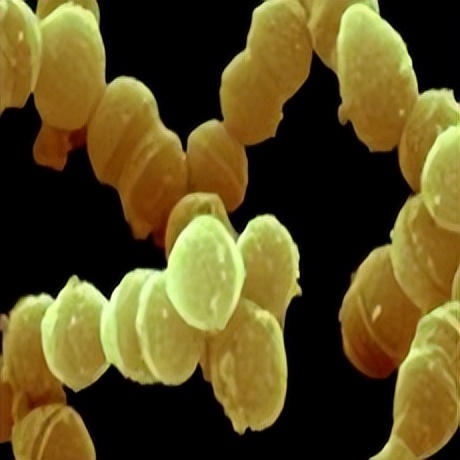 看懂较强抗菌、抗菌、较强抑菌、抑菌、抗菌制剂、抑菌制剂？