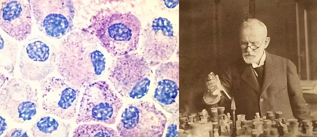 日军给*安妇慰**打的606药剂是什么?痛苦的化疗药物砷凡纳明