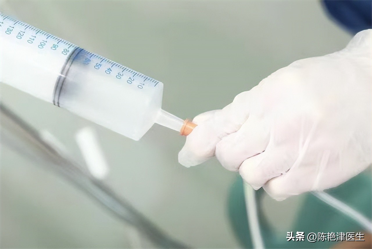 咽炎查出食管癌,以为是慢性咽炎却是食管癌