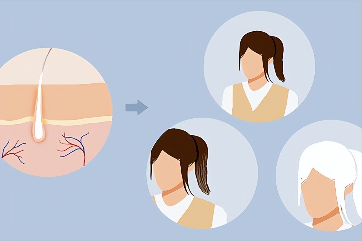 头发变白的秘诀和方法,头发白了就不会变白吗