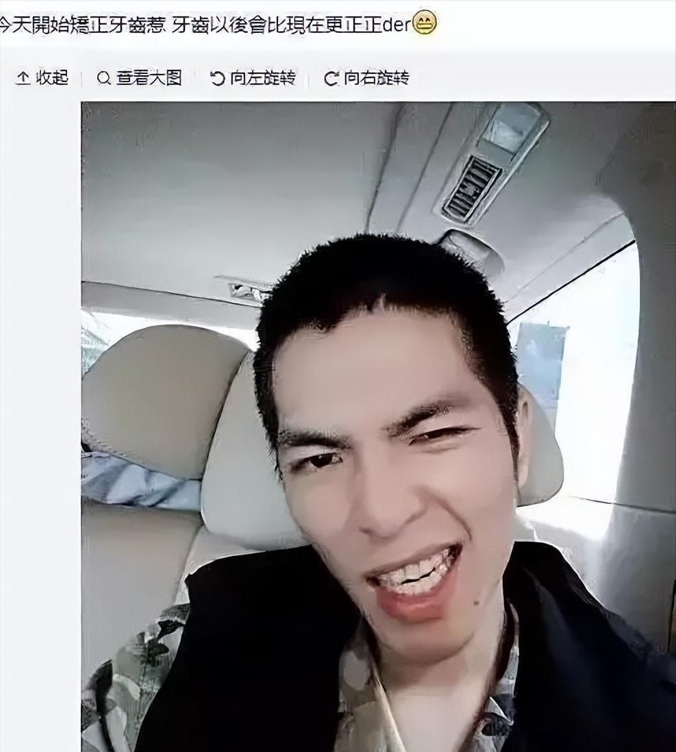 明星的牙都很齐吗,明星的牙齿都很好看