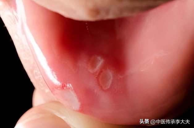 药店一般不推荐的8个中成药,药店不建议买的5种药品