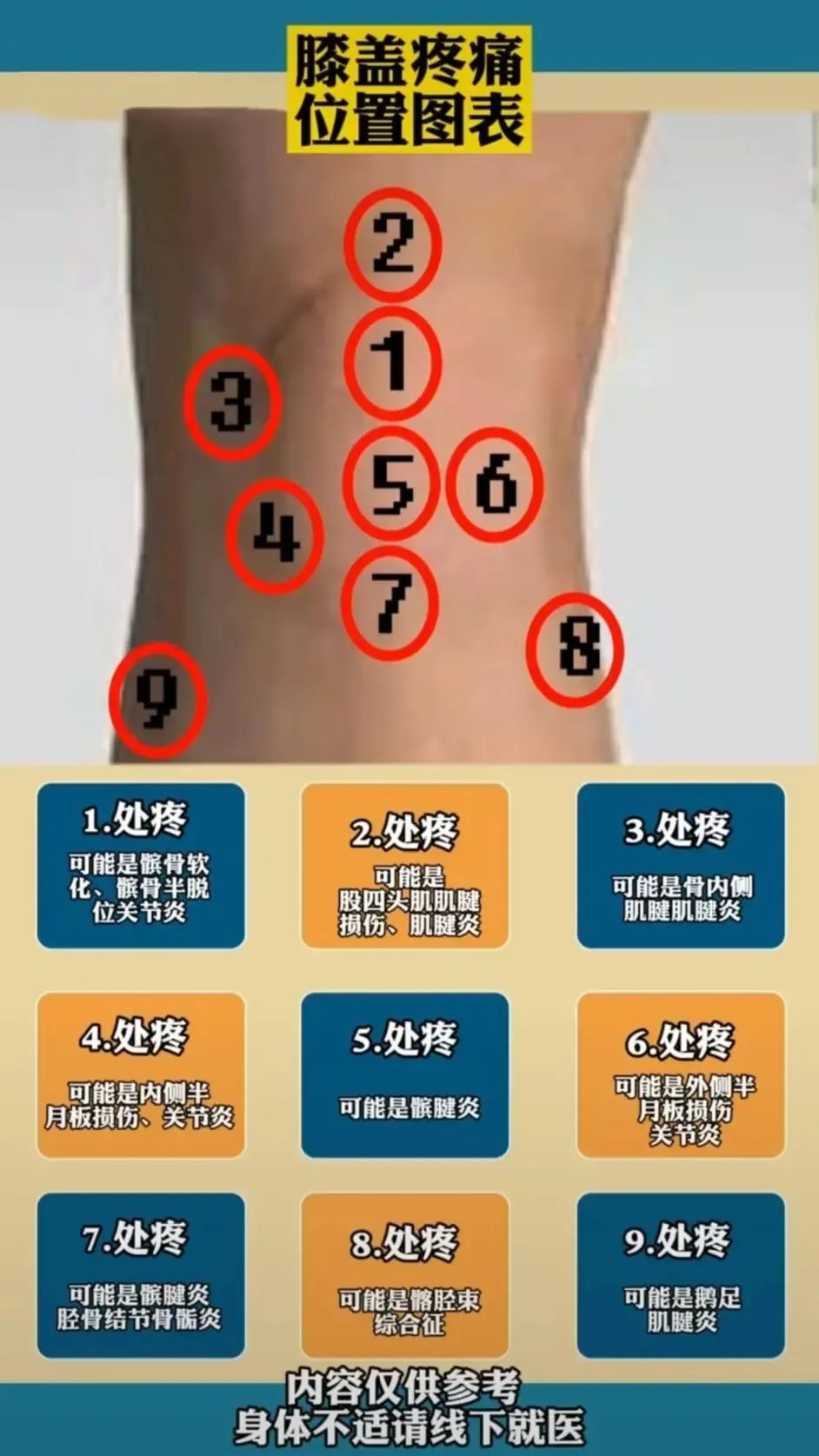 膝盖髌骨软骨疼痛部位对照表,膝盖下方胫骨疼痛部位对照表