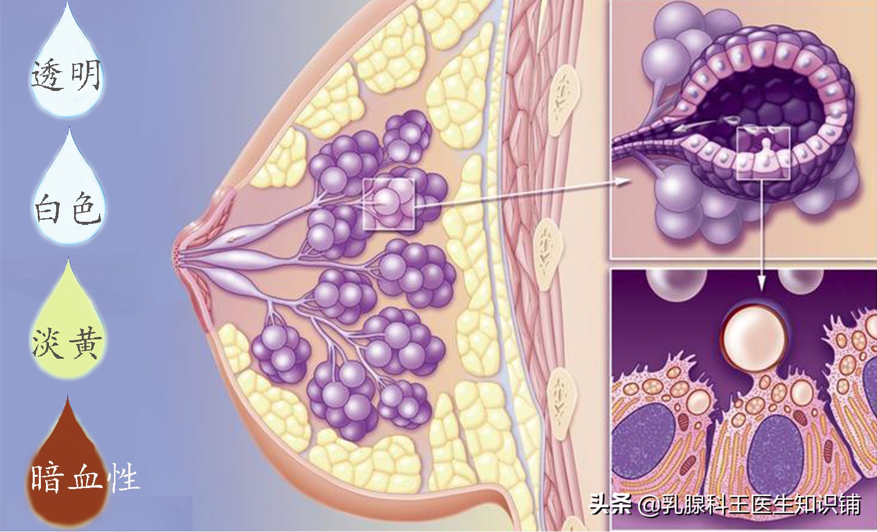 乳头出现溢液的发生率这么高，你意识到了吗？