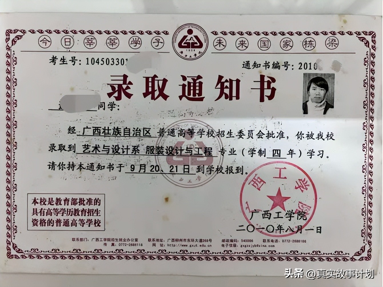 骨牵引护理手术,骨牵引的手术指征