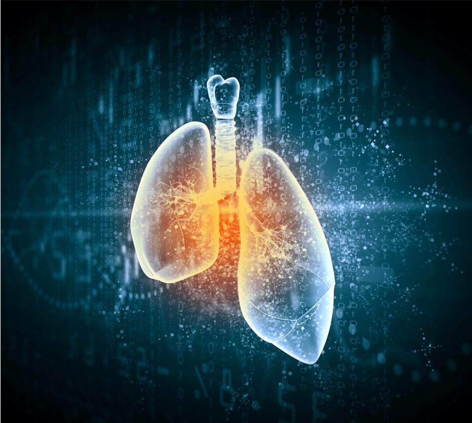 肺癌靶向治疗注意事项,肺癌如何选择靶向治疗药物