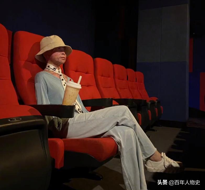 19年,四川20岁女孩遭大火毁容48%烧伤,双臂截肢如今怎么样了?