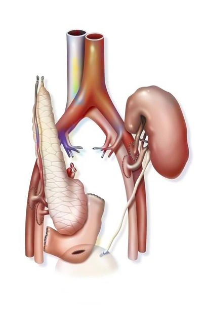 哪些止泻药比较好用没有副作用,实惠又好用的止泻药有哪些
