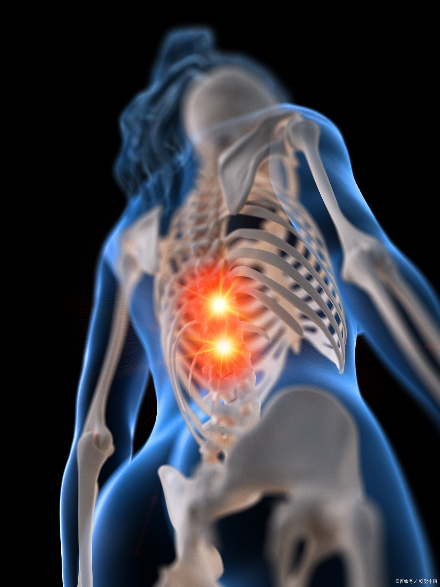 下肢麻木疼痛用什么药,下肢麻木疼痛行走多了加重