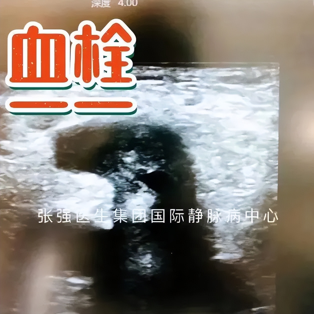 朱筱吟医生的头条号,朱筱吟医生的抖音