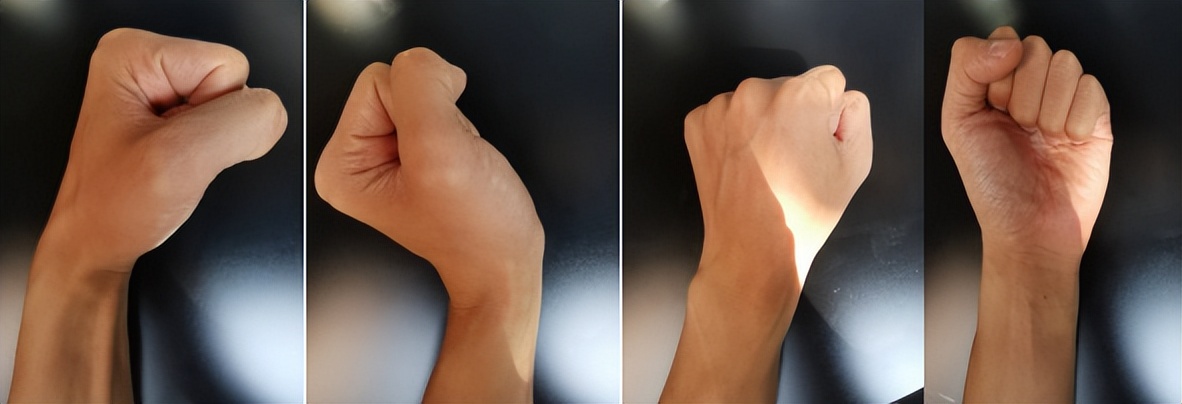 桡骨远端骨折的护理方法,手腕桡骨远端骨折后的恢复过程