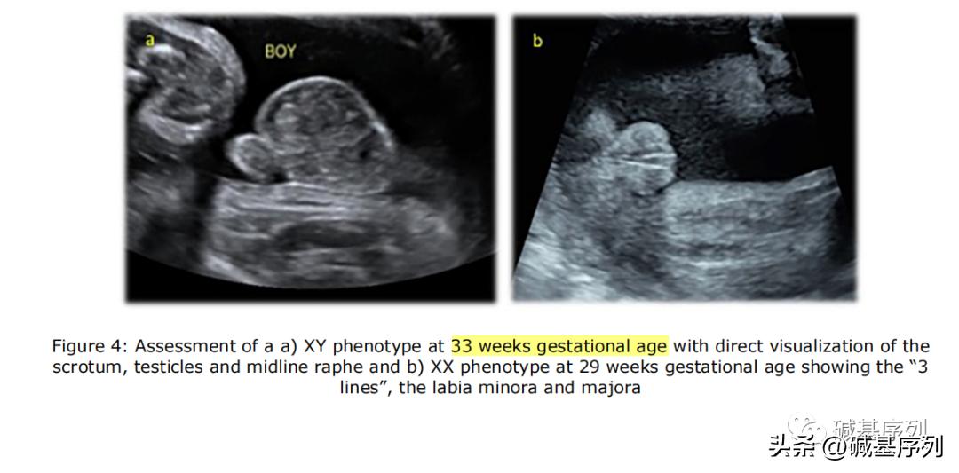 怀孕了第一胎宝宝会知道么,怀孕胎儿外貌什么时候确定